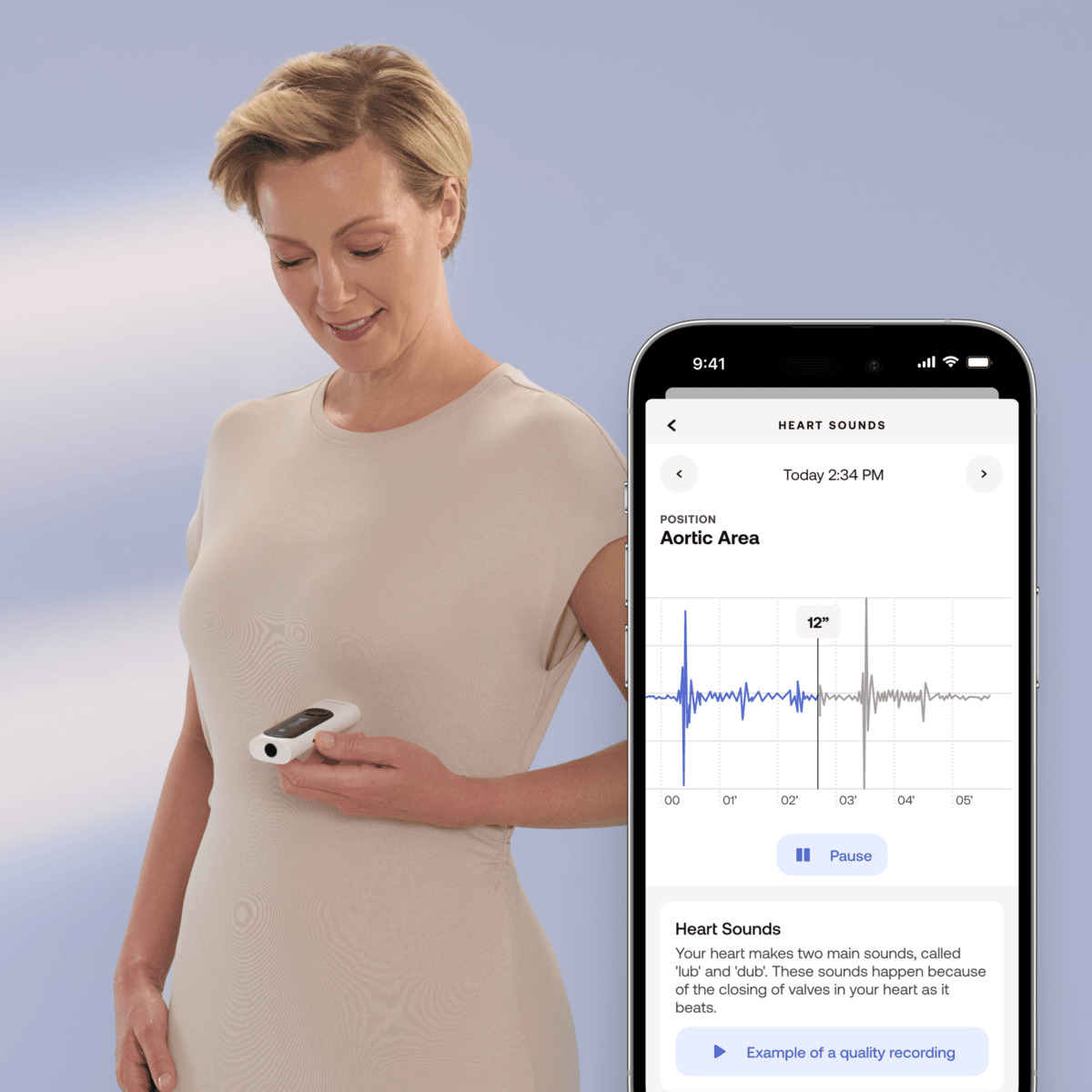 Withings 4 в 1 health MultiScan - бял